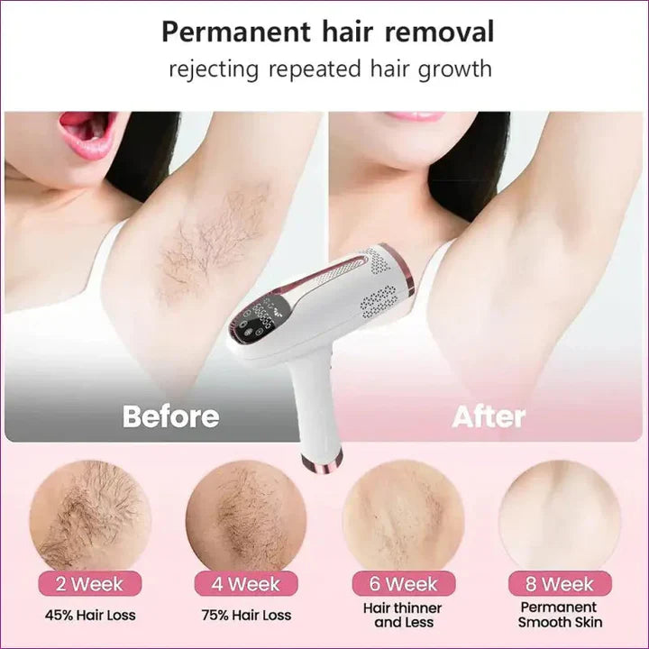 Viviane IPL Hair Remover Smooth Skin Fast 5 Level Device