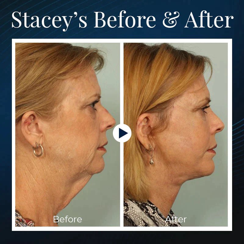 Aurora V Face Beauty Device Lift Tone Overnight