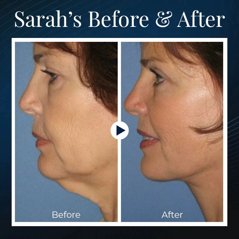 Aurora V Face Beauty Device Lift Tone Overnight