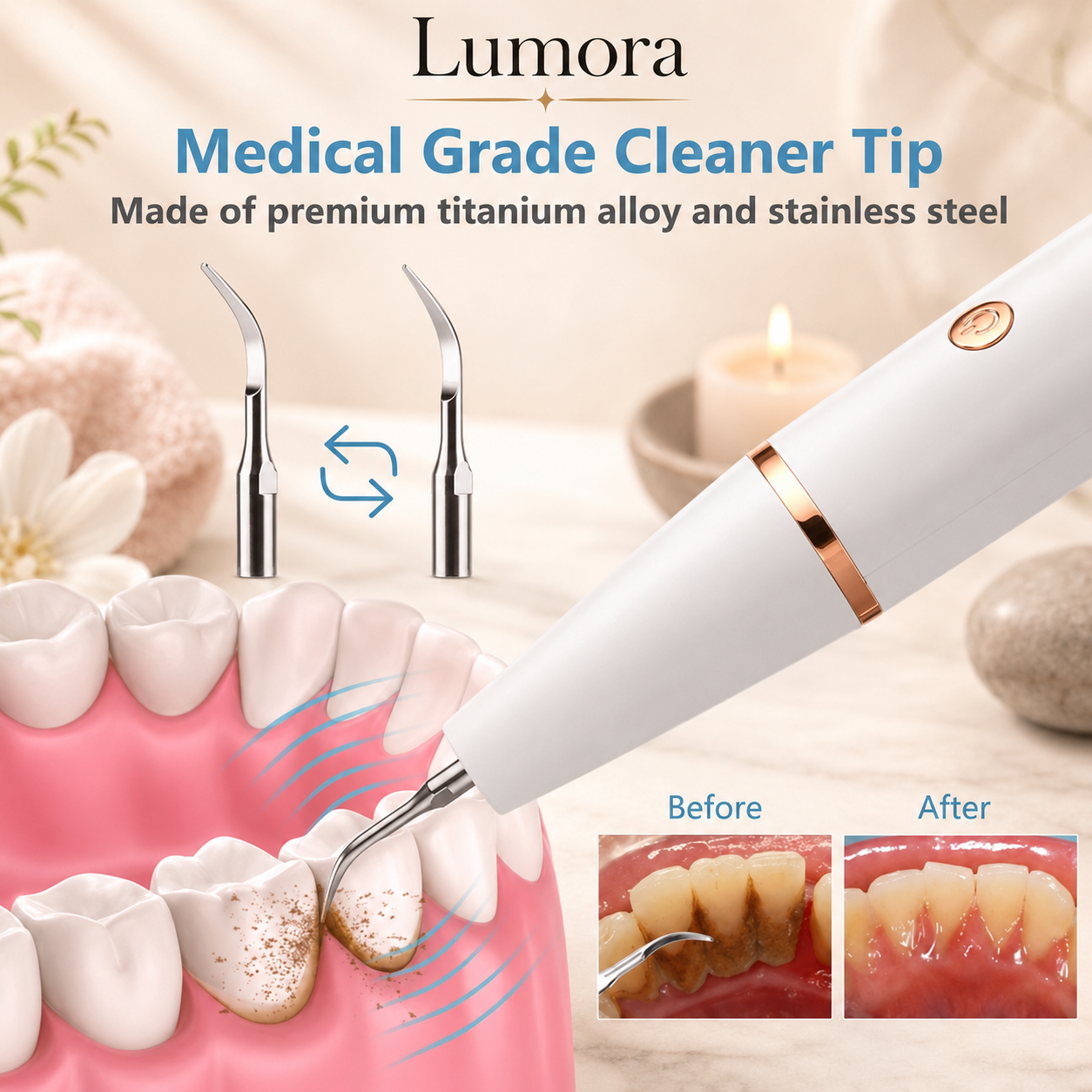 Ysabel Ultrasonic Tartar Remover Cleaner Smile, USB Rechargeable, LED