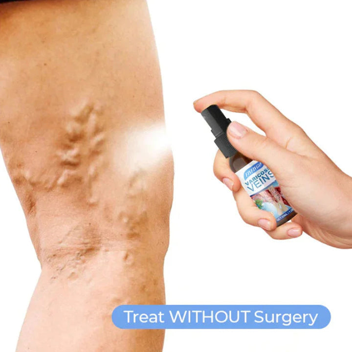 Amelie Vein Care Spray Soothe, Smooth, Plant Based