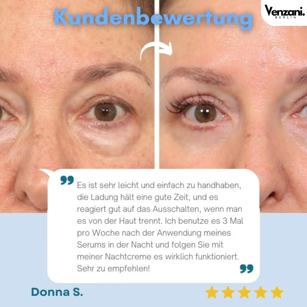 Adira Face Lifting Device Firm Skin, Smooth Lines, EMS