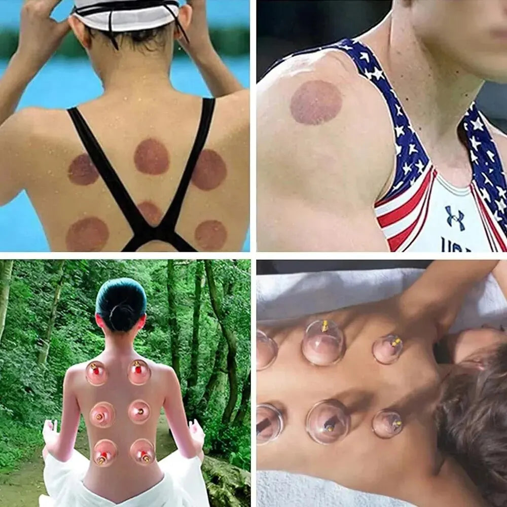 VitalCups Vacuum Cupping Set Muscle Relief, Easy Recovery