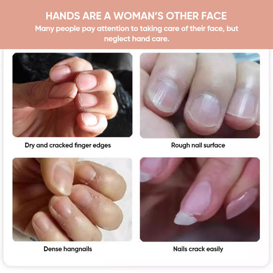 Amora Nail Growth Oil Stronger Nails Daily Repair