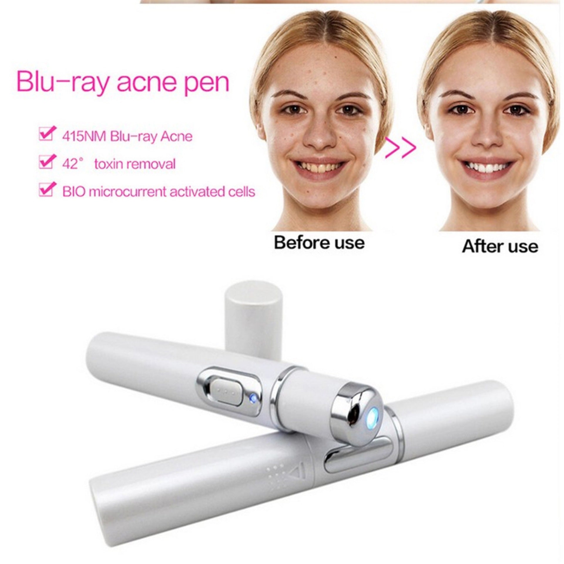 Leonor Blue Light Acne Wand Clear Skin, Calm Pores, Portable