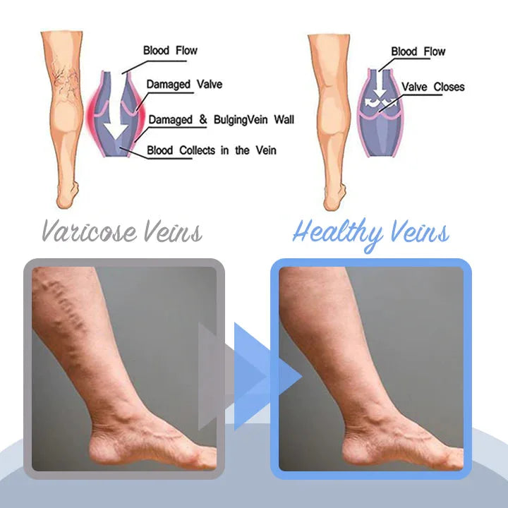 Amelie Vein Care Spray Soothe, Smooth, Plant Based