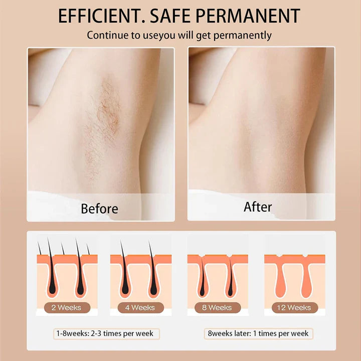 Viviane IPL Hair Remover Smooth Skin Fast 5 Level Device