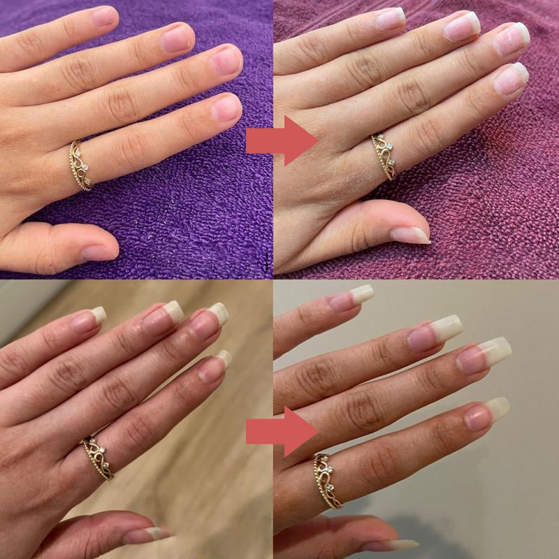 Amora Nail Growth Oil Stronger Nails Daily Repair