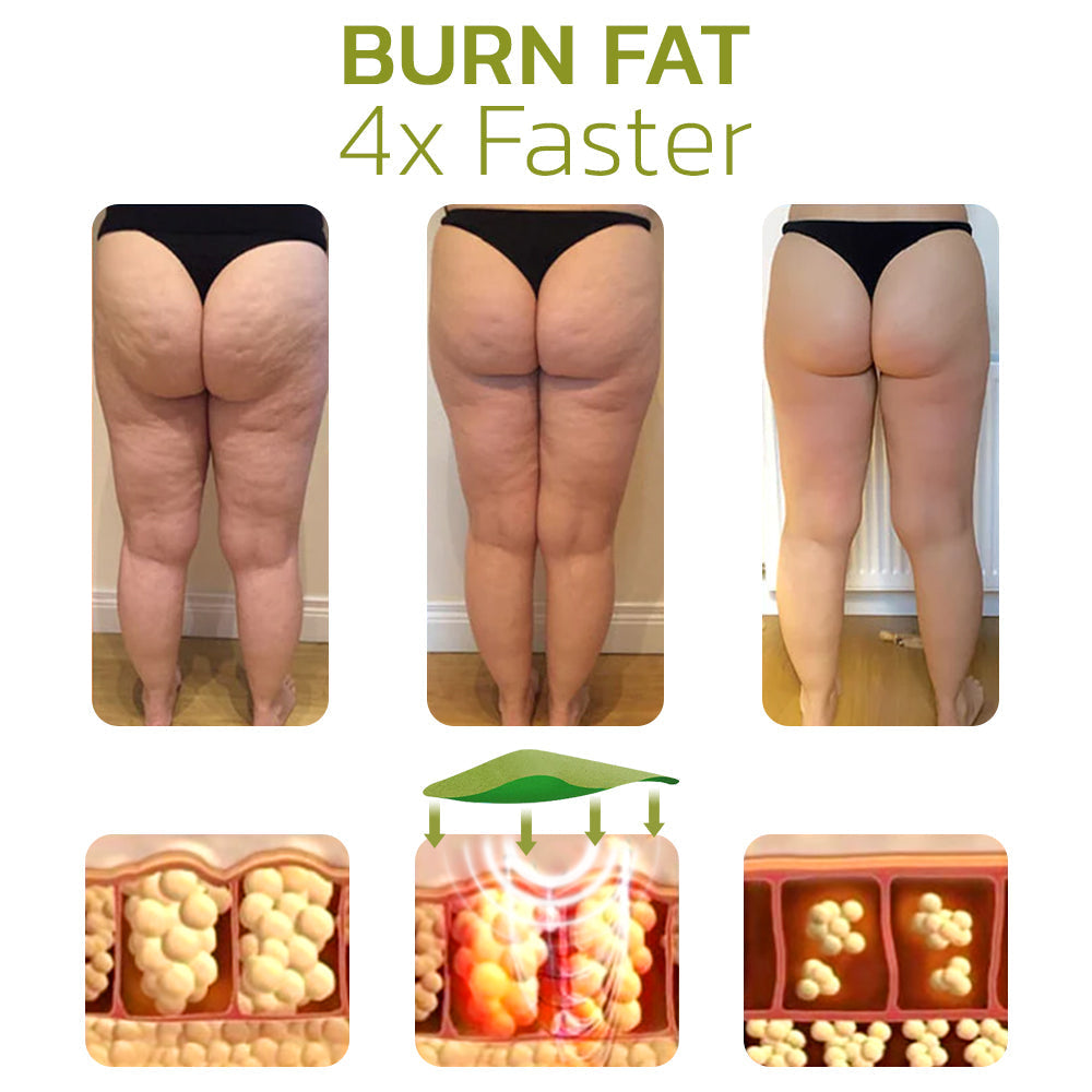 Sydney Cellulite Reduction Patches Firmer Smoother Overnight