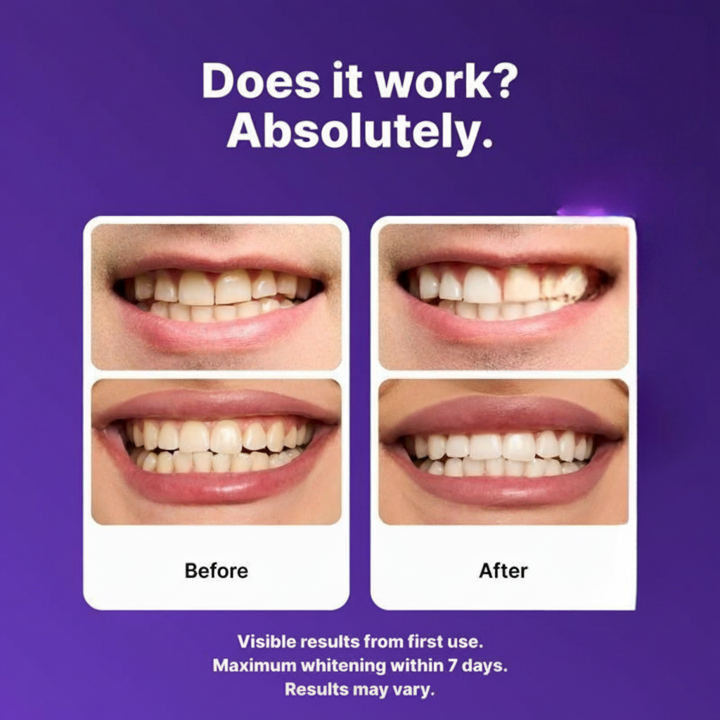 Aesha Whitening Strips Gentle Brightening, No Sensitivity