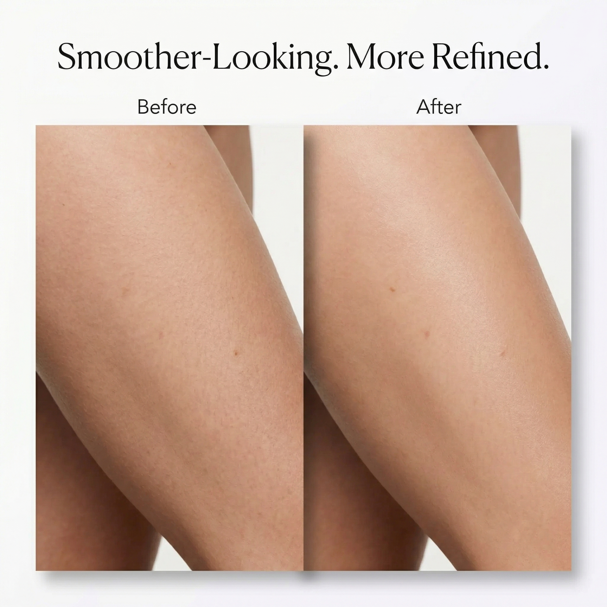 Diana SculptCup Heated Cupping Massager