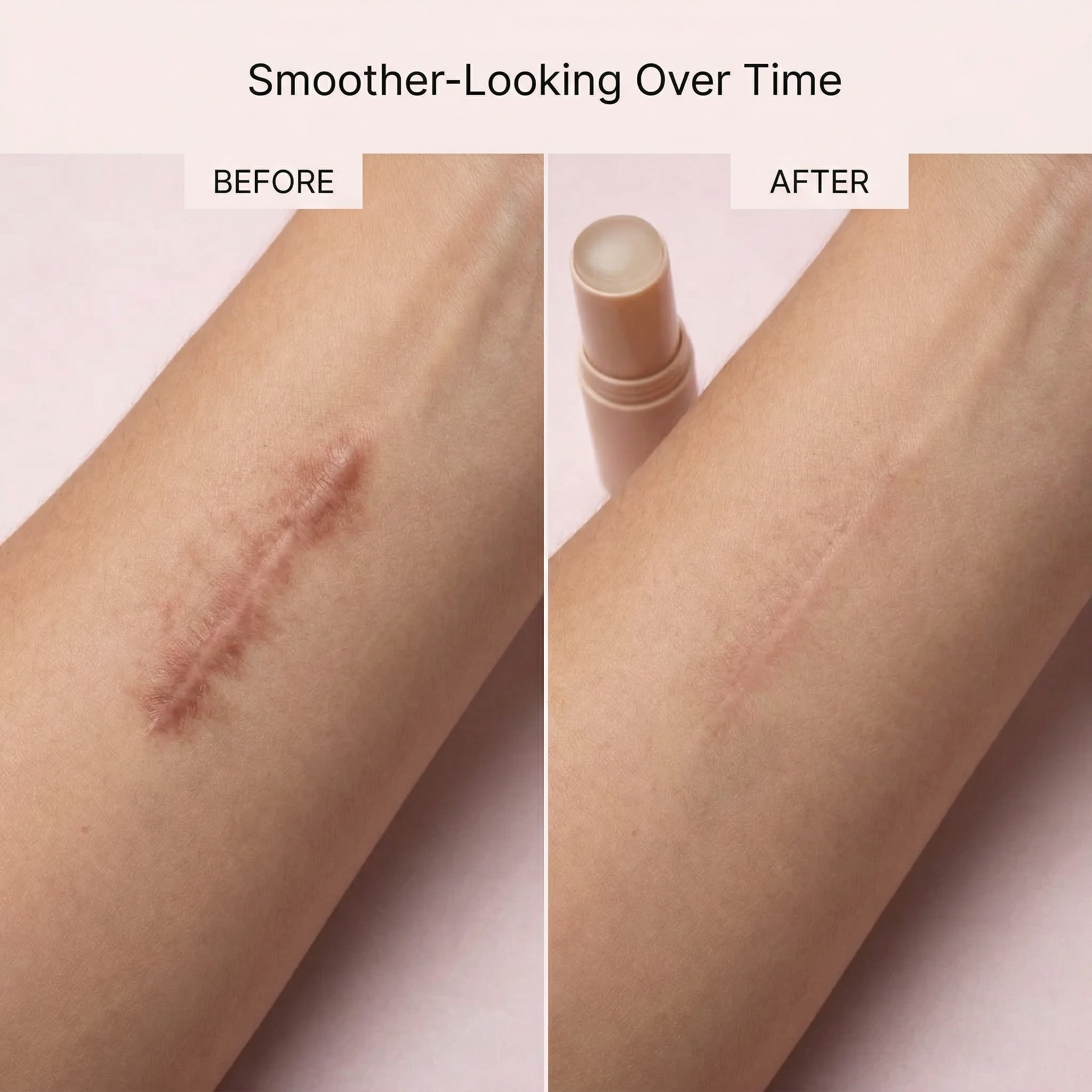 Sera Scar Care Stick
