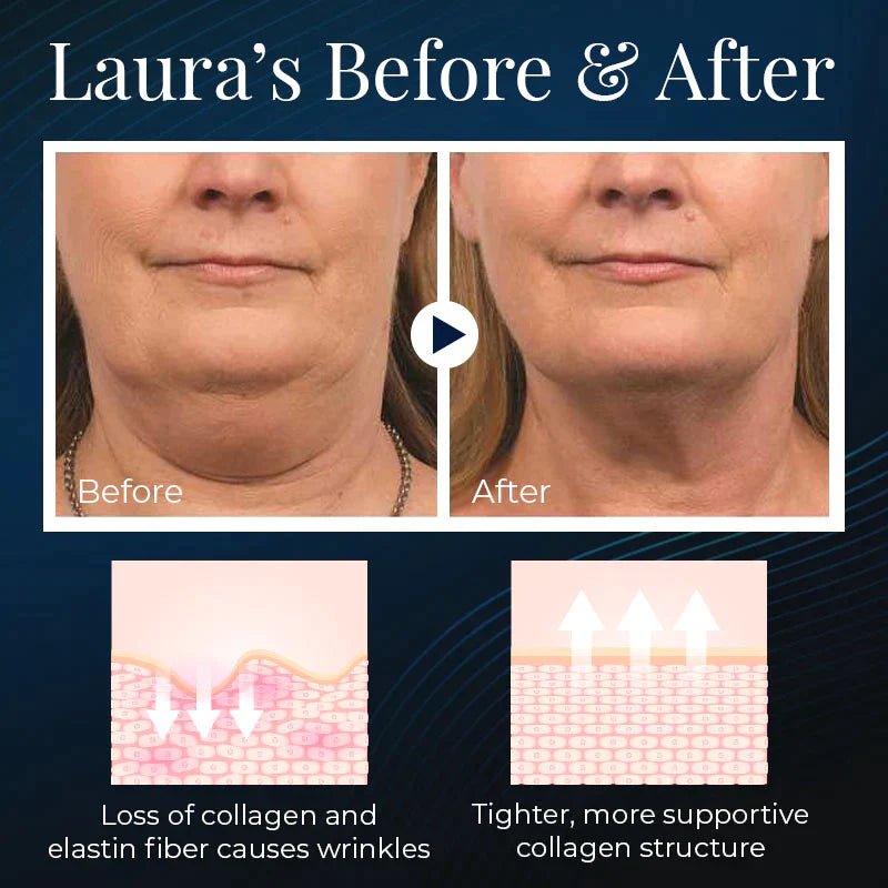 Aurora V Face Beauty Device Lift Tone Overnight