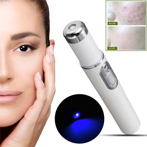 Leonor Blue Light Acne Wand Clear Skin, Calm Pores, Portable