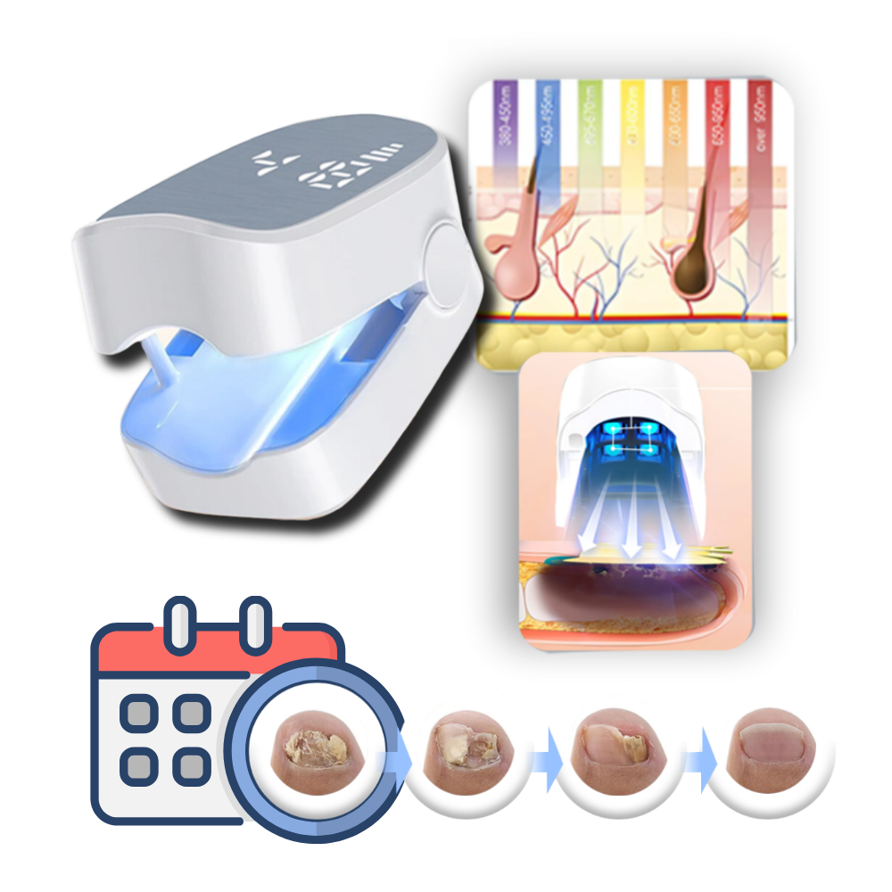 Clea Nail Fungus Laser Nail Clarity Daily Ease Dual Laser