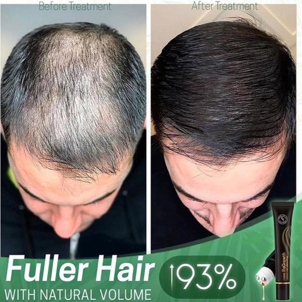 Regine Hair Growth Serum Roller Hydrates Fuller Looking Roots